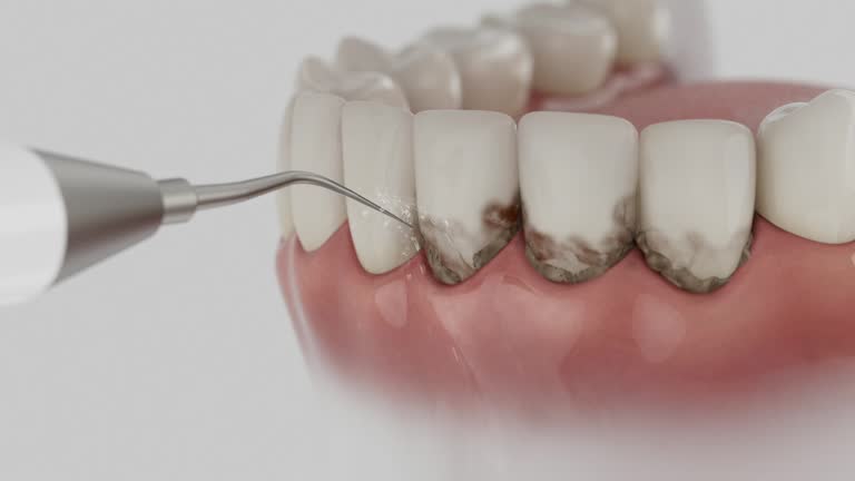 Reliable Dental Implants contractor in Hillcrest, IL by Smile Center Dentistry